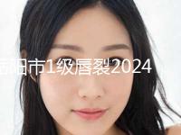 岳阳市1级唇裂2024价格表明细查询(2024年5月均价为：31270元）