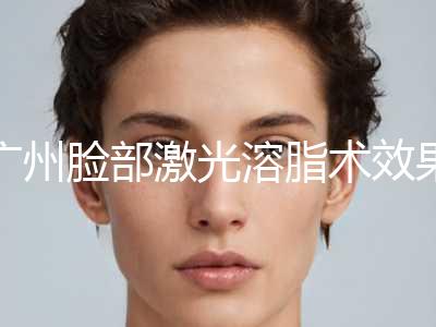 广州脸部激光溶脂术效果好不好价格是多少